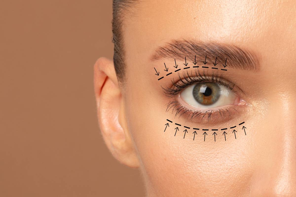 featured image for blog asking is eyelid surgery painful