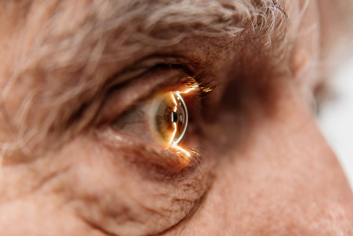 Featured image for What Are the Symptoms of Cataracts and Glaucoma